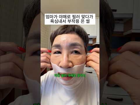 올리브영 스킨케어 전 알아두어야 할 필러 부작용과 관리법